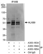 HLXB9 Antibody in Immunoprecipitation (IP)