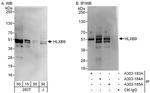 HLXB9 Antibody in Western Blot (WB)