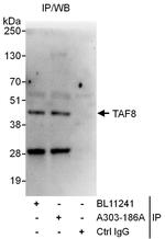 TAF8 Antibody in Immunoprecipitation (IP)