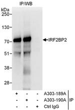 IRF2BP2 Polyclonal Antibody