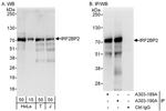 IRF2BP2 Polyclonal Antibody