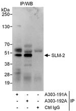 SLM-2 Polyclonal Antibody