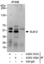 SLM-2 Polyclonal Antibody