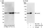 CerS2 Antibody in Western Blot (WB)