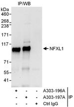 NFXL1 Antibody in Immunoprecipitation (IP)