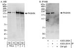 PASKIN Antibody in Western Blot (WB)