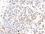 SF1 Antibody in Immunohistochemistry (Paraffin) (IHC (P))