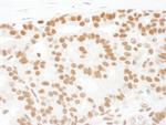 SF1 Antibody in Immunohistochemistry (Paraffin) (IHC (P))
