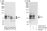SF1 Antibody in Western Blot (WB)