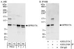 SFRS17A Polyclonal Antibody