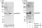SFMBT1 Polyclonal Antibody