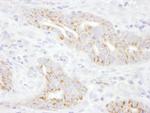 TXNIP Polyclonal Antibody