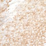 YB1 Polyclonal Antibody