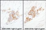 YB1 Polyclonal Antibody