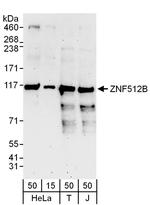 ZNF512B Polyclonal Antibody
