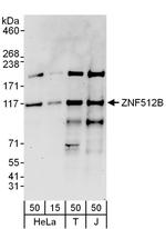 ZNF512B Polyclonal Antibody