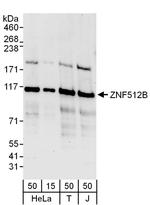 ZNF512B Polyclonal Antibody