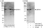 ZBTB11 Polyclonal Antibody