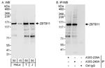 ZBTB11 Polyclonal Antibody