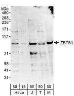 ZBTB1 Polyclonal Antibody