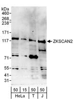 ZKSCAN2 Polyclonal Antibody