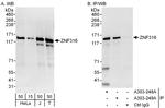 ZNF316 Polyclonal Antibody