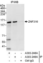 ZNF316 Polyclonal Antibody