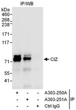 CIZ Polyclonal Antibody