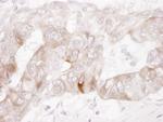 c-Kit Antibody in Immunohistochemistry (Paraffin) (IHC (P))