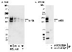 c-Kit Antibody in Western Blot (WB)