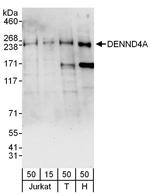 DENND4A Polyclonal Antibody