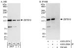 ZBTB10 Polyclonal Antibody