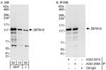 ZBTB10 Polyclonal Antibody