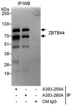 ZBTB44 Polyclonal Antibody