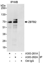 ZBTB2 Polyclonal Antibody