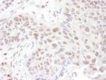 ZNF462 Polyclonal Antibody