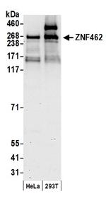 ZNF462 Antibody in Western Blot (WB)