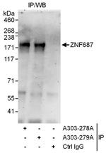 ZNF687 Polyclonal Antibody