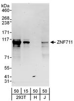 ZNF711 Polyclonal Antibody