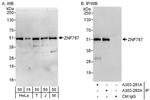 ZNF787 Antibody in Western Blot (WB)
