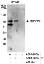 SH3BP2 Polyclonal Antibody