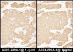 LASP1 Antibody in Immunohistochemistry (Paraffin) (IHC (P))