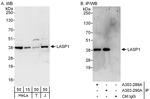 LASP1 Antibody in Western Blot (WB)