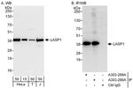 LASP1 Antibody in Western Blot (WB)