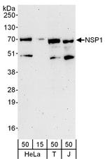 NSP1 Polyclonal Antibody
