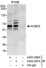 ACBD5 Polyclonal Antibody