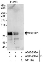 SSX2IP Polyclonal Antibody