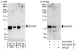 SSX2IP Polyclonal Antibody
