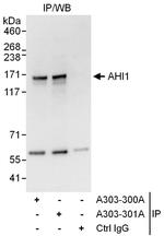 AHI1 Polyclonal Antibody