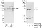 AHI1 Polyclonal Antibody